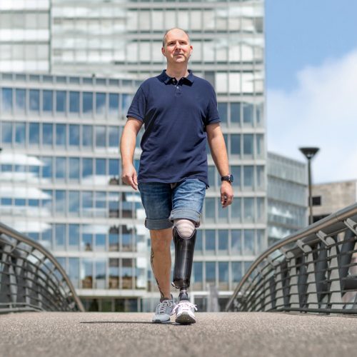 Beinprothese im daily Life - Lentes Prothesenwerkstatt Köln